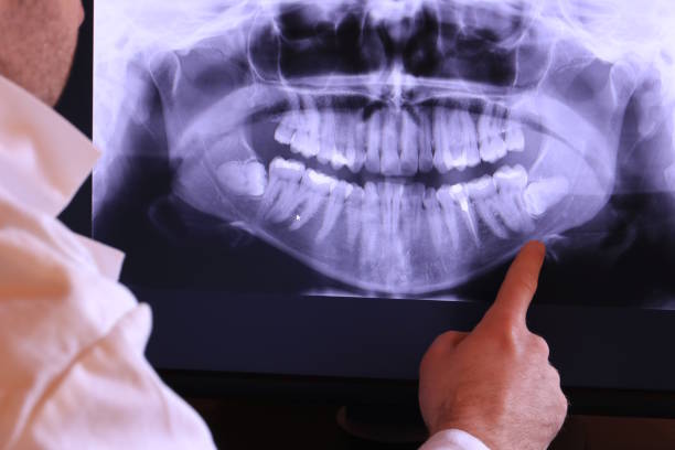 Best Orthodontic Emergency Dentist in Bondurant, IA