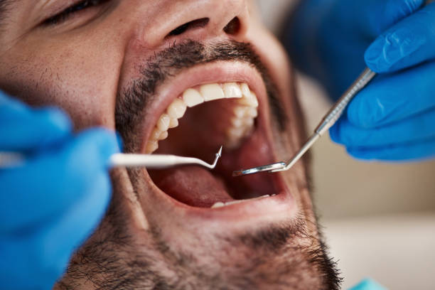 Best Emergency Dentist for Knocked-Out Tooth in Bondurant, IA
